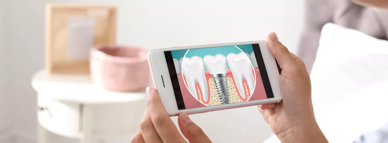 Dental Videos