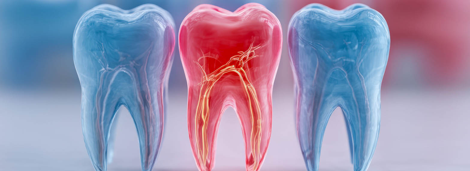 Root Canals