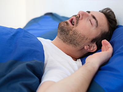 Sleep Apnea